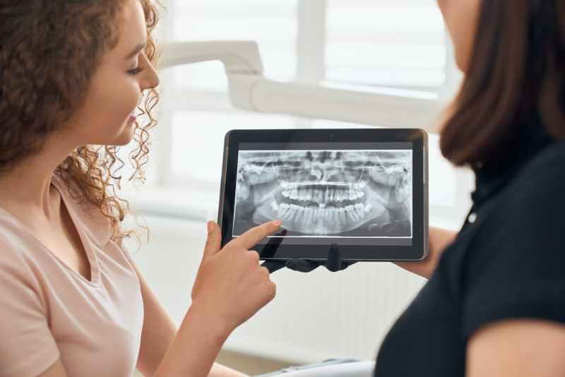 A women and dentist looking at a computer screen with an digital x-ray on it