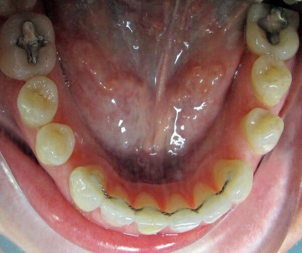 Female After 17