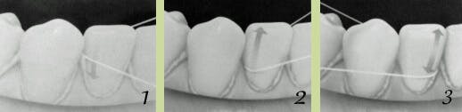 Flossing Flossing